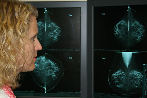 Breast imaging