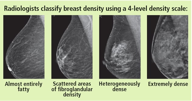 https://info.iowaradiology.com/hs-fs/hubfs/breast%20density.png?width=631&height=336&name=breast%20density.png