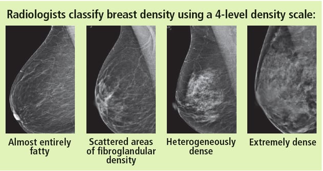 breast density.png