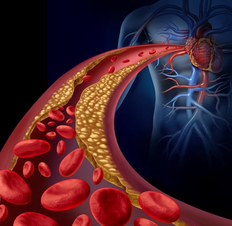 cardiac calcium