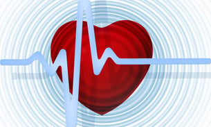 Cardiac calcium scoring