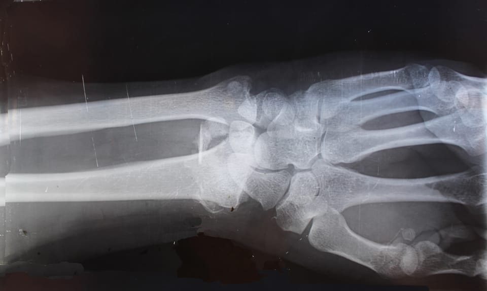 xray-of-arm